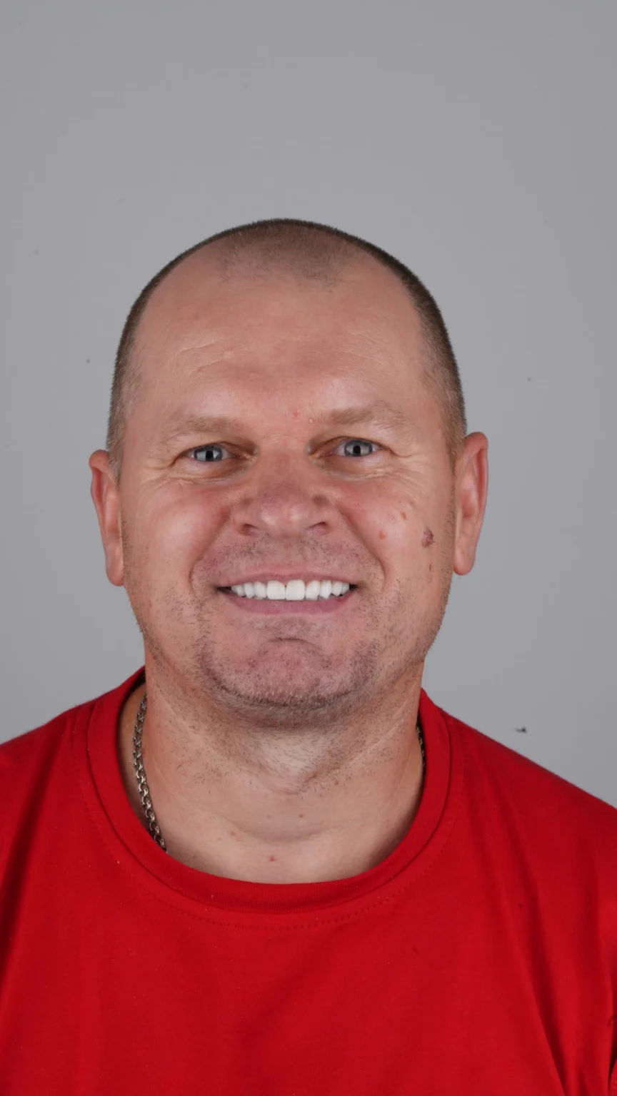 Циркониевые коронки