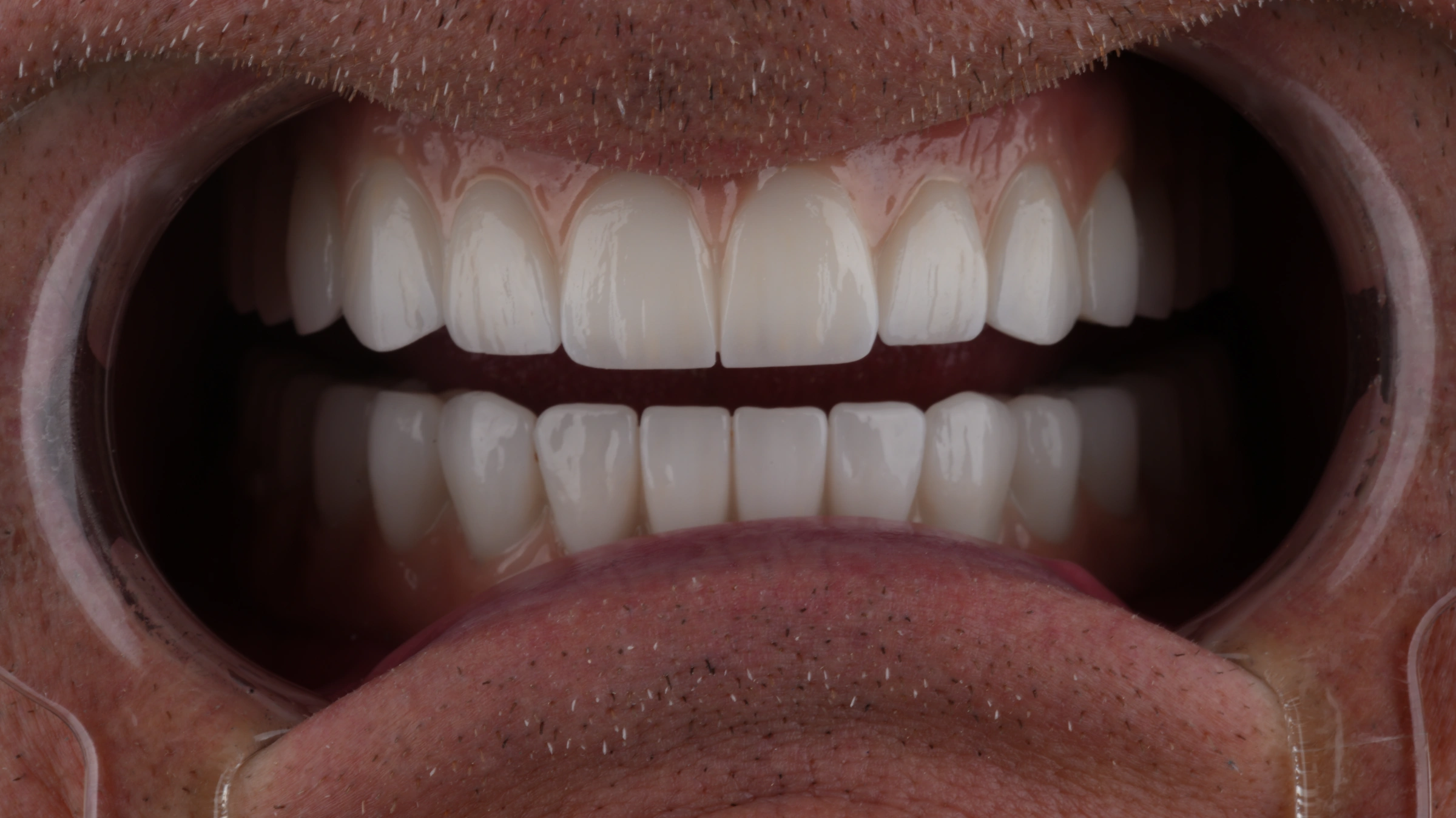 После преображения