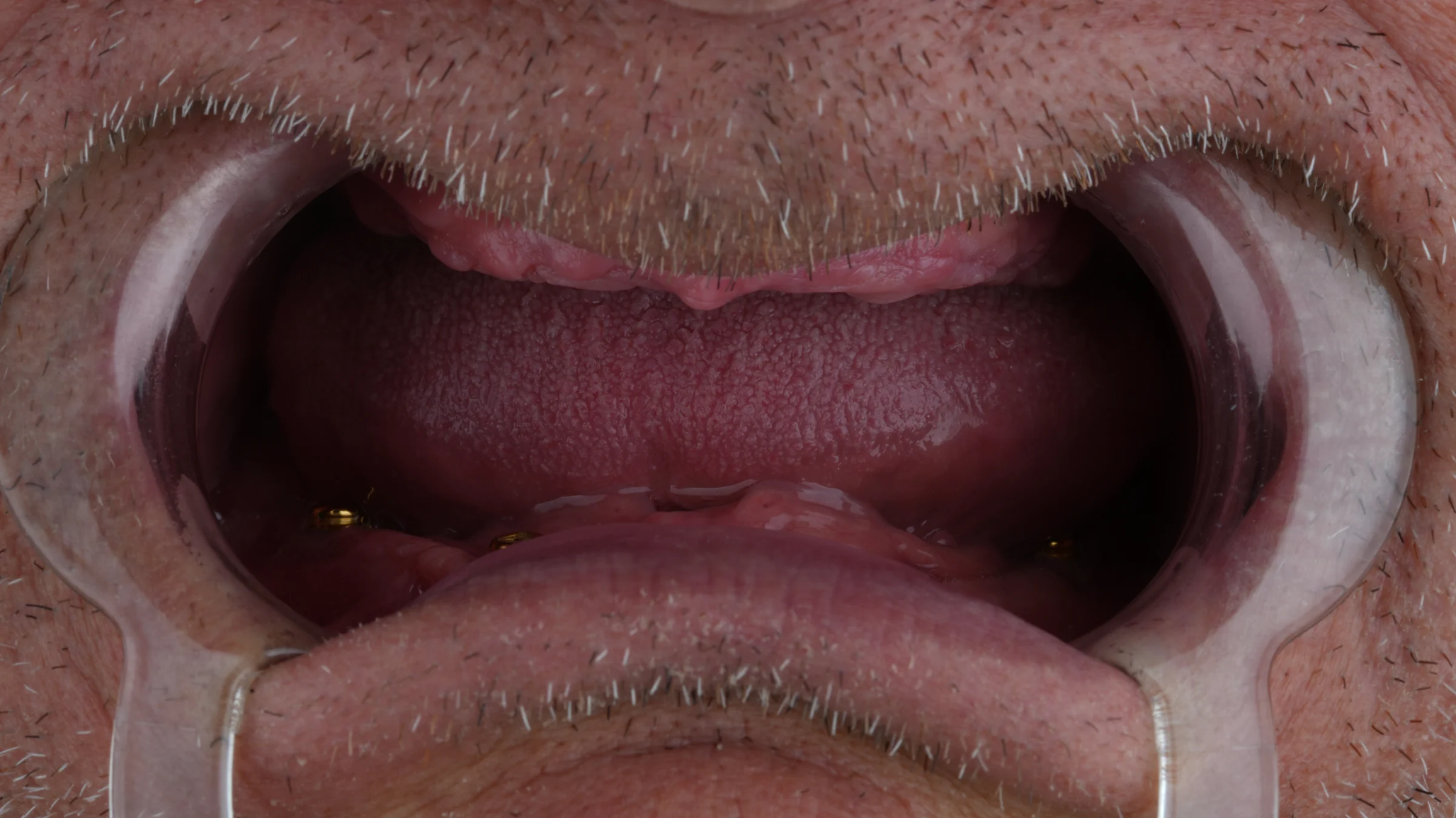 До преображения