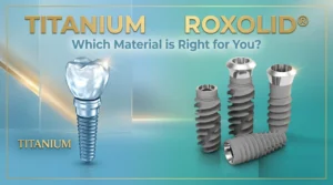 itanium vs. Roxolid®: Which Dental Implants Material is Right for You?