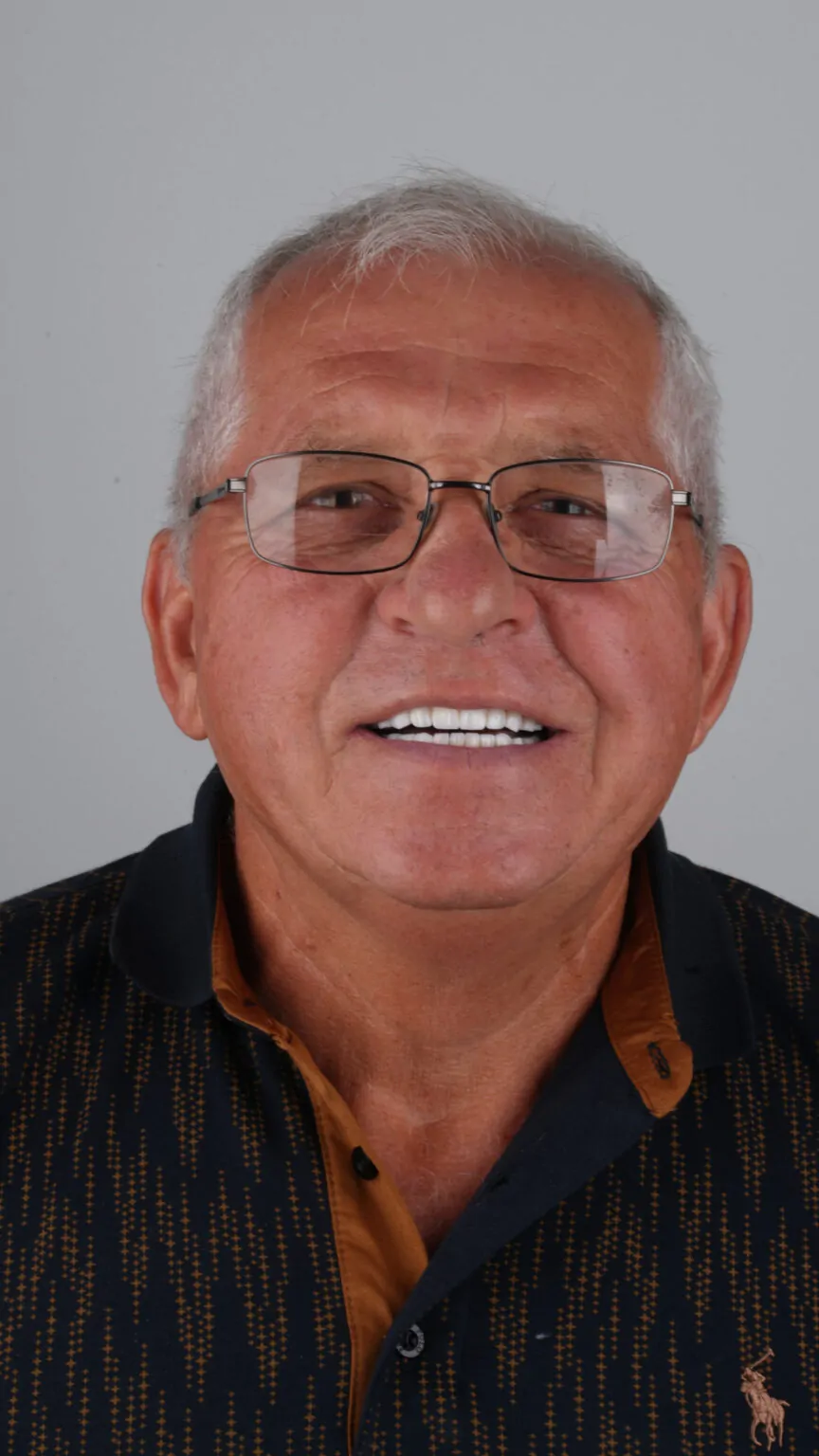 Дизайн улыбки