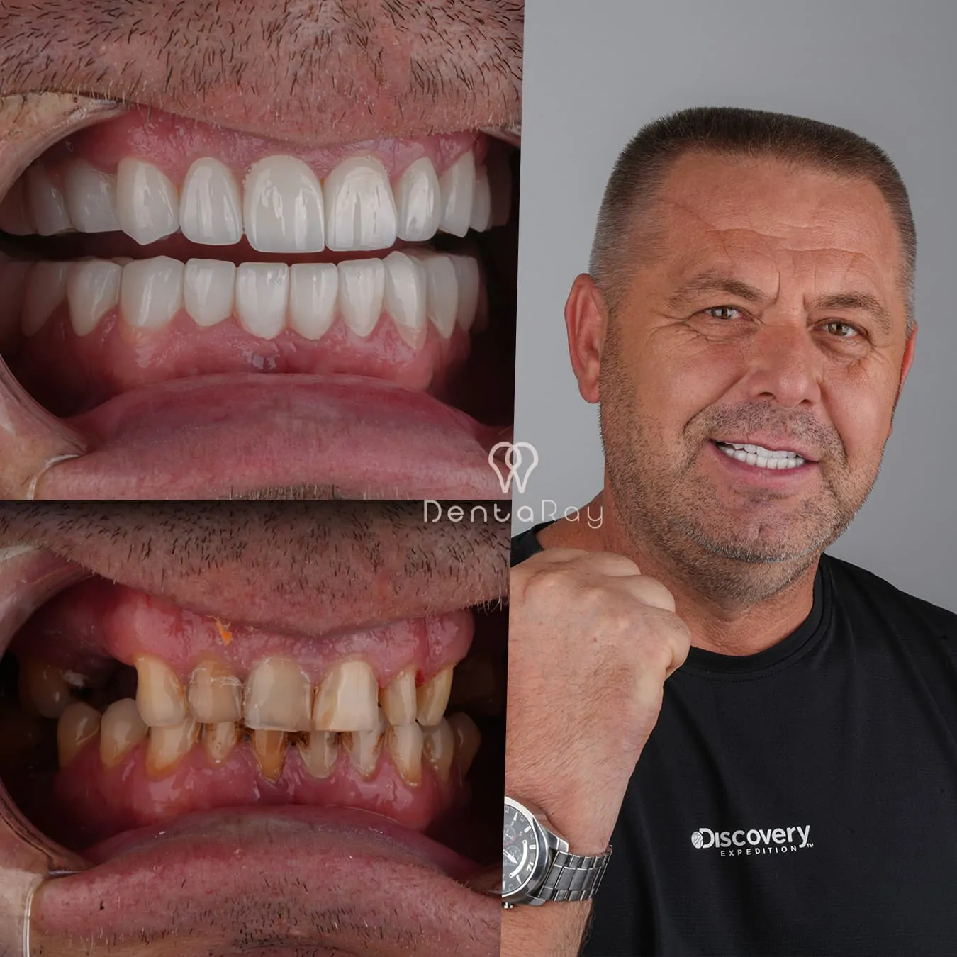 Улыбающийся пациент