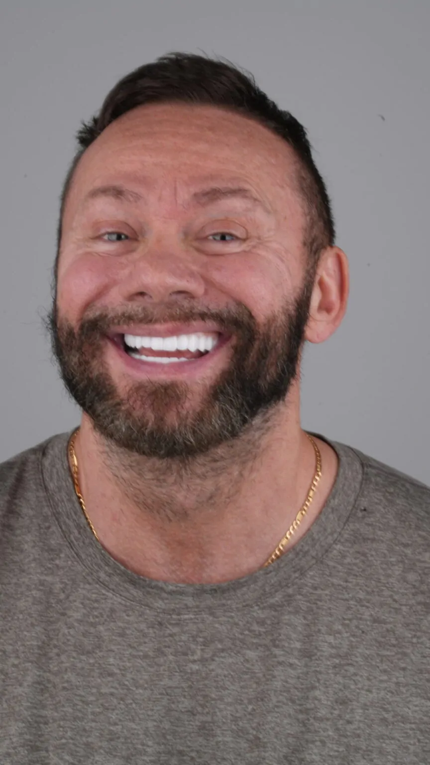 Премиальные виниры